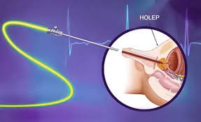 HoLEP Ameliyatı